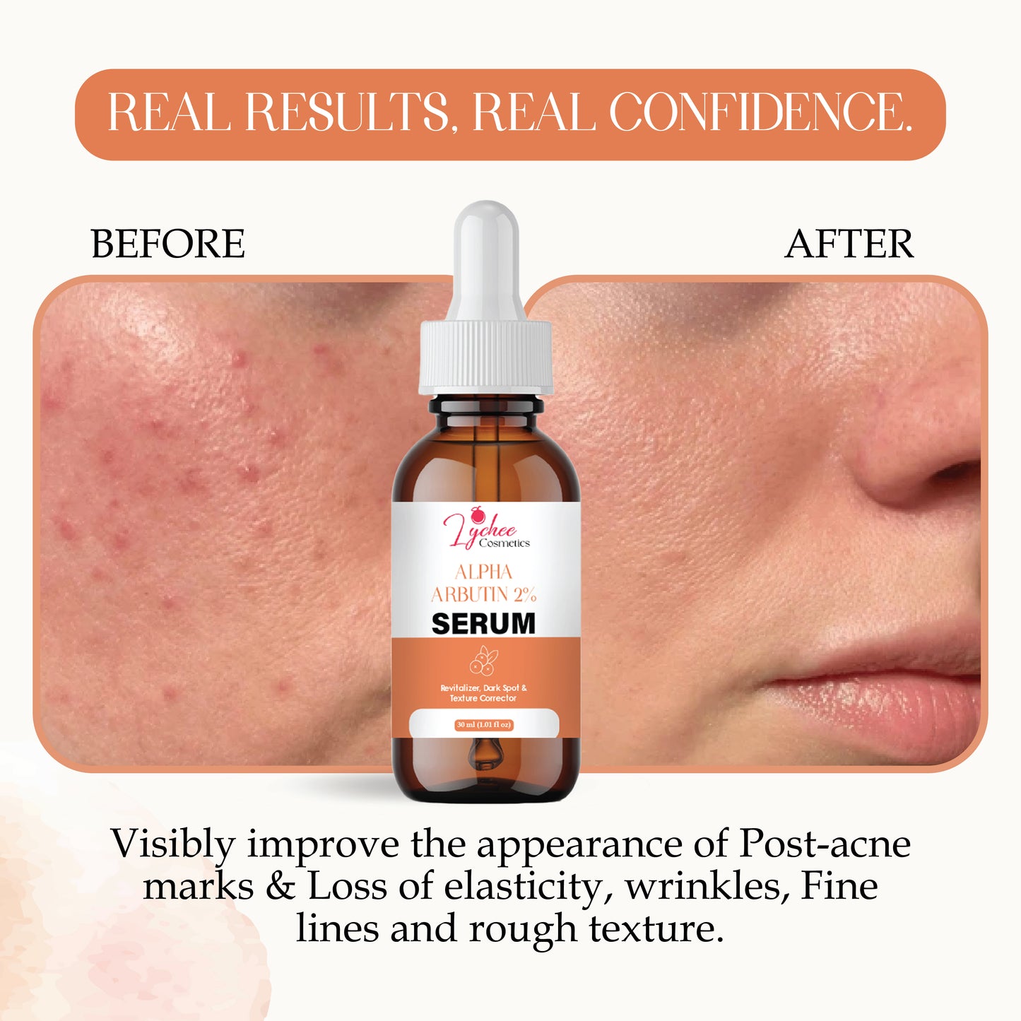 Alpha Arbutin Serum for Skin Brightening & Spot Reduction | Even Skin Tone | Lightweight, Non-Sticky Face Serum for Men & Women