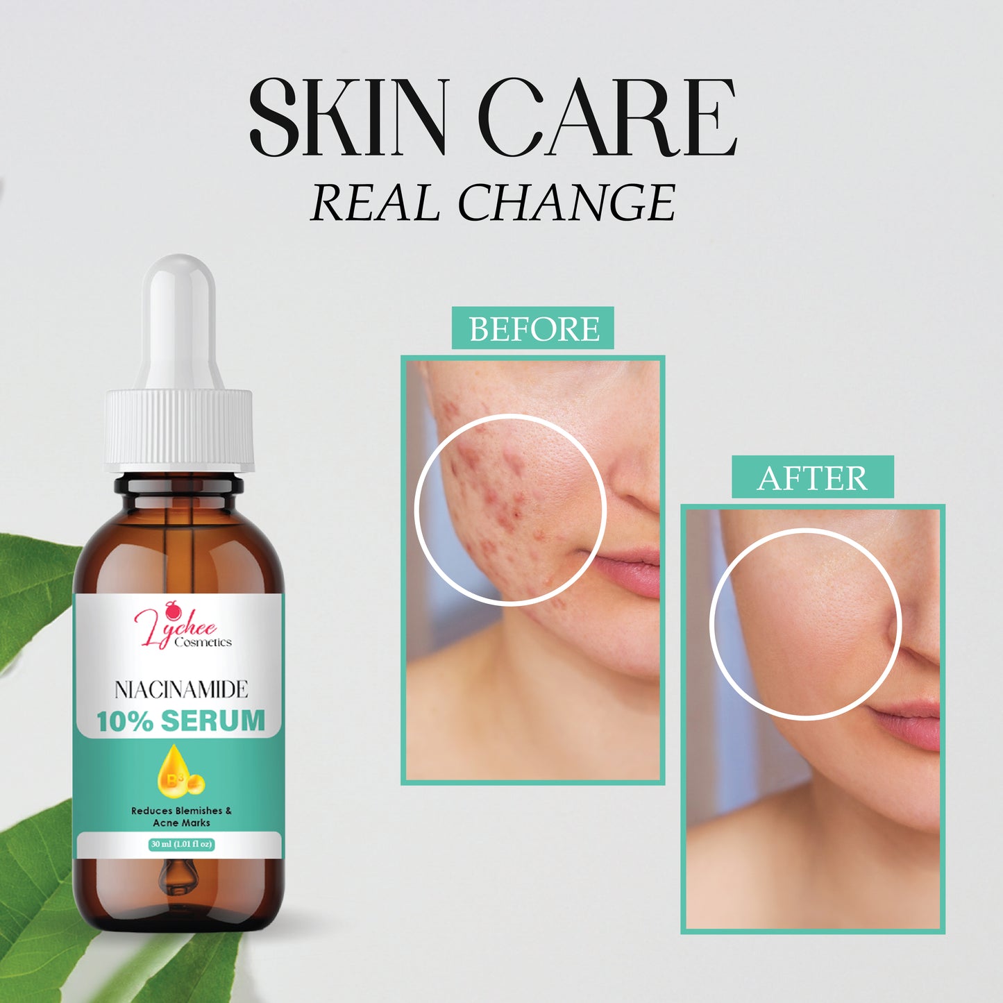 Niacinamide Face Serum for Clear & Bright Skin | 10% Niacinamide with Zinc | Reduces Acne Marks, Dark Spots & Oil Control | Lightweight, Non-Greasy Formula