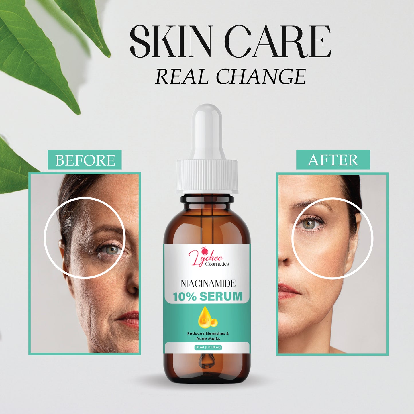 Niacinamide Face Serum for Clear & Bright Skin | 10% Niacinamide with Zinc | Reduces Acne Marks, Dark Spots & Oil Control | Lightweight, Non-Greasy Formula