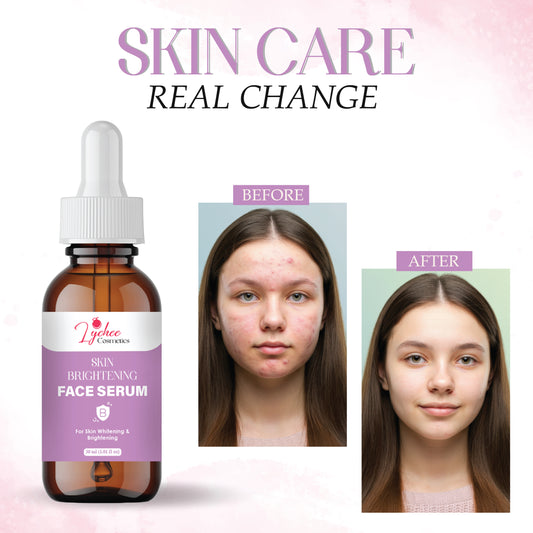 Skin Brightening Serum for Face | Dark Spot Removal, Even Skin Tone & Glow | Lightweight & Fast Absorbing | Suitable for All Skin Types